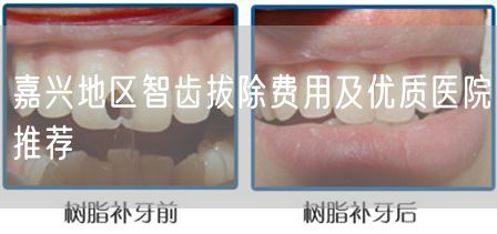 嘉兴地区智齿拔除费用及优质医院推荐(图1)