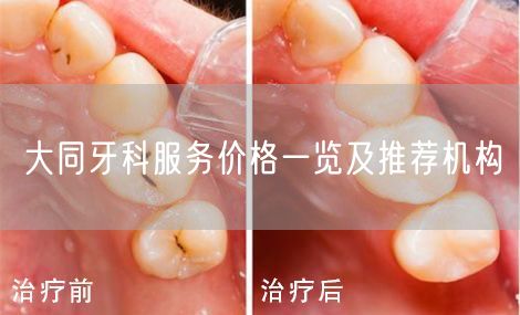 大同牙科服务价格一览及推荐机构(图1)