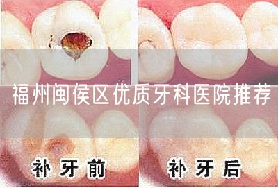 福州闽侯区优质牙科医院推荐