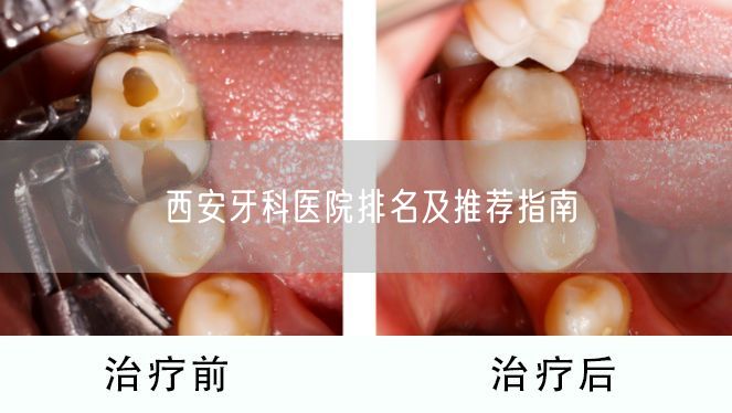 西安牙科医院排名及推荐指南