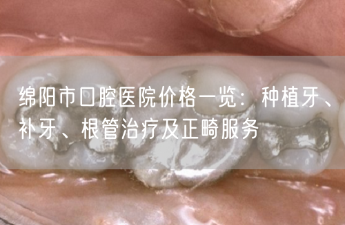 绵阳市口腔医院价格一览：种植牙、补牙、根管治疗及正畸服务