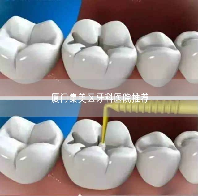 厦门集美区牙科医院推荐