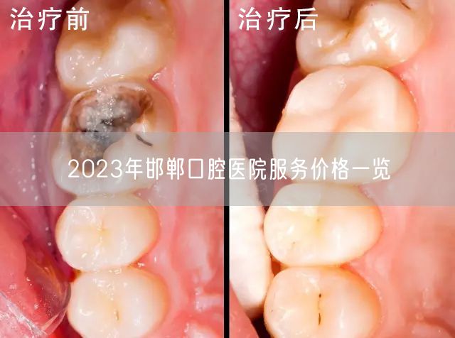 2023年邯郸口腔医院服务价格一览