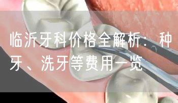 临沂牙科价格全解析：种牙、洗牙等费用一览