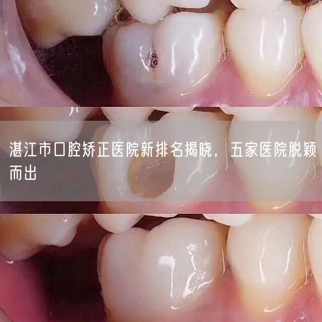 湛江市口腔矫正医院新排名揭晓，五家医院脱颖而出(图1)