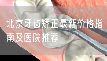 北京牙齿矫正最新价格指南及医院推荐(图1)