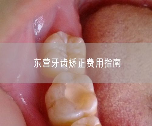 东营牙齿矫正费用指南
