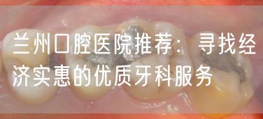兰州口腔医院推荐：寻找经济实惠的优质牙科服务