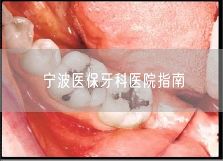 宁波医保牙科医院指南