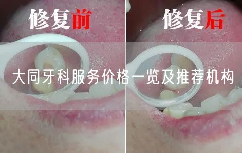 大同牙科服务价格一览及推荐机构