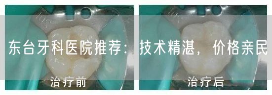 东台牙科医院推荐：技术精湛，价格亲民(图1)