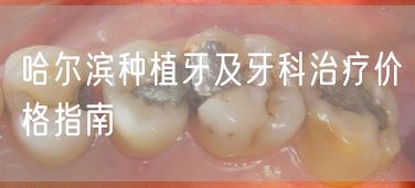哈尔滨种植牙及牙科治疗价格指南