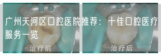 广州天河区口腔医院推荐：十佳口腔医疗服务一览
