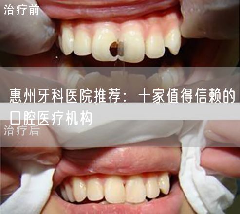 惠州牙科医院推荐：十家值得信赖的口腔医疗机构