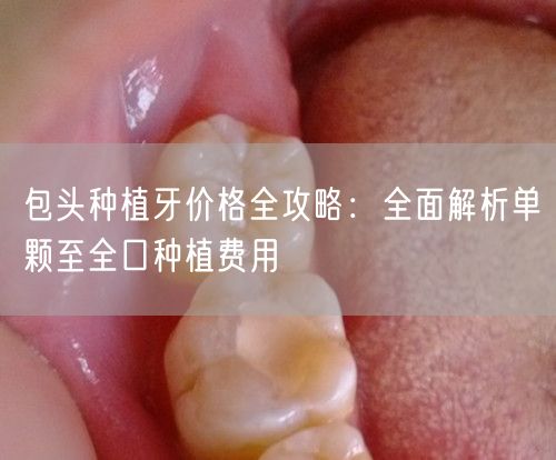 包头种植牙价格全攻略：全面解析单颗至全口种植费用