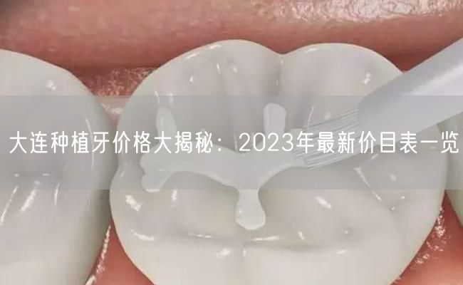 大连种植牙价格大揭秘：2023年最新价目表一览