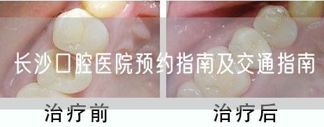 长沙口腔医院预约指南及交通指南
