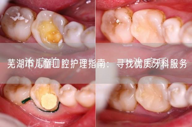 芜湖市儿童口腔护理指南：寻找优质牙科服务
