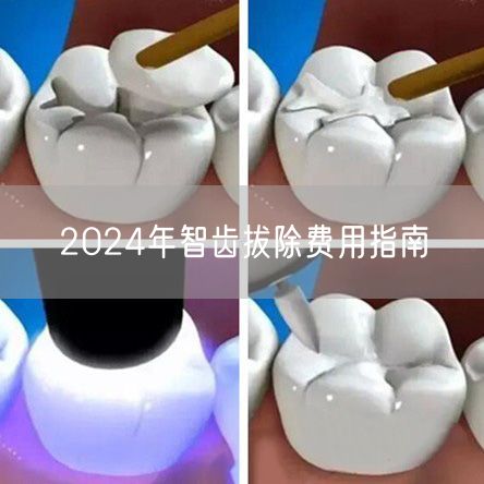 2024年智齿拔除费用指南