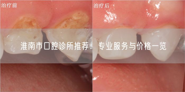 淮南市口腔诊所推荐：专业服务与价格一览(图1)