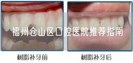 福州仓山区口腔医院推荐指南