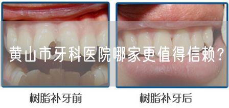 黄山市牙科医院哪家更值得信赖？