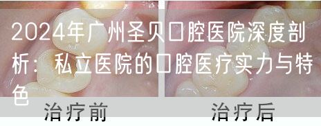 2024年广州圣贝口腔医院深度剖析：私立医院的口腔医疗实力与特色