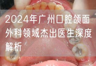 2024年广州口腔颌面外科领域杰出医生深度解析