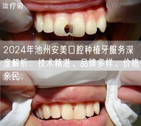 2024年池州安美口腔种植牙服务深度解析：技术精湛、品牌多样、价格亲民