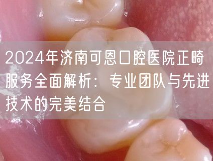 2024年济南可恩口腔医院正畸服务全面解析：专业团队与先进技术的完美结合