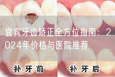 宜宾牙齿矫正全方位指南：2024年价格与医院推荐