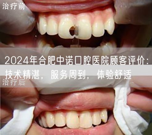 2024年合肥中诺口腔医院顾客评价：技术精湛，服务周到，体验舒适