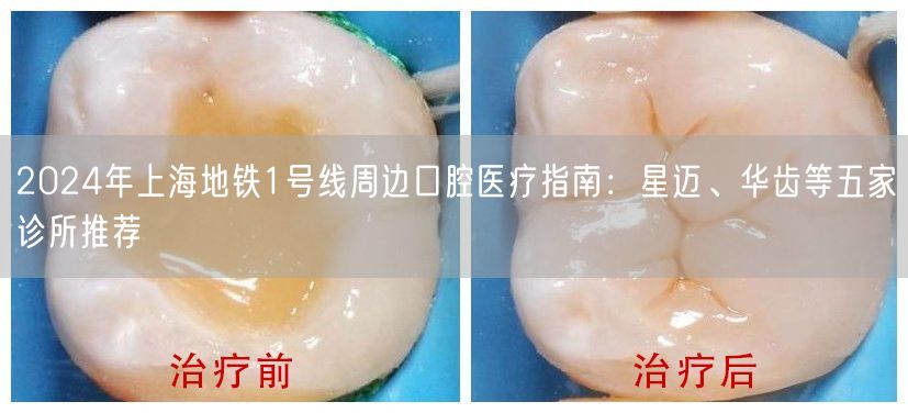 2024年上海地铁1号线周边口腔医疗指南：星迈、华齿等五家诊所推荐