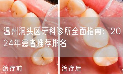 温州洞头区牙科诊所全面指南：2024年患者推荐排名