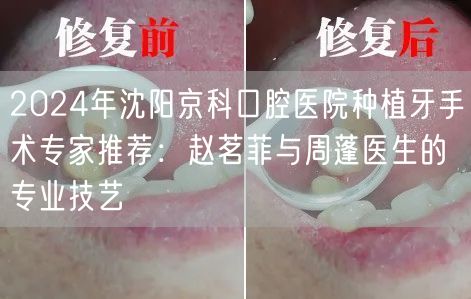 2024年沈阳京科口腔医院种植牙手术专家推荐：赵茗菲与周蓬医生的专业技艺