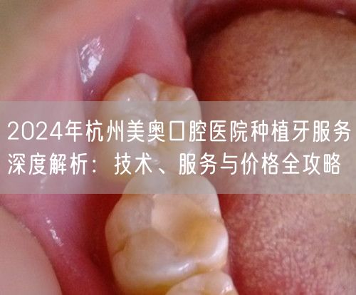 2024年杭州美奥口腔医院种植牙服务深度解析：技术、服务与价格全攻略