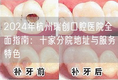 2024年杭州瑞创口腔医院全面指南：十家分院地址与服务特色
