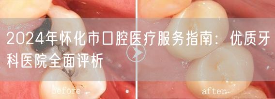 2024年怀化市口腔医疗服务指南：优质牙科医院全面评析