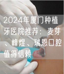 2024年厦门种植牙医院推荐：麦芽、峰煜、瑞恩口腔值得信赖