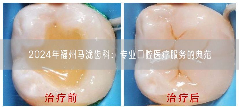 2024年福州马泷齿科：专业口腔医疗服务的典范