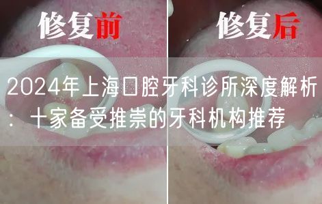 2024年上海口腔牙科诊所深度解析：十家备受推崇的牙科机构推荐