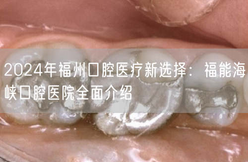 2024年福州口腔医疗新选择：福能海峡口腔医院全面介绍