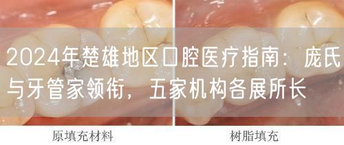 2024年楚雄地区口腔医疗指南：庞氏与牙管家领衔，五家机构各展所长