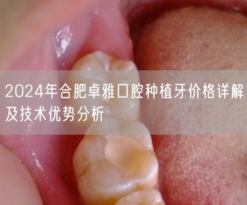 2024年合肥卓雅口腔种植牙价格详解及技术优势分析