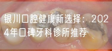 银川口腔健康新选择：2024年口碑牙科诊所推荐