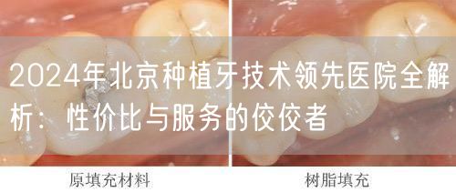 2024年北京种植牙技术领先医院全解析：性价比与服务的佼佼者