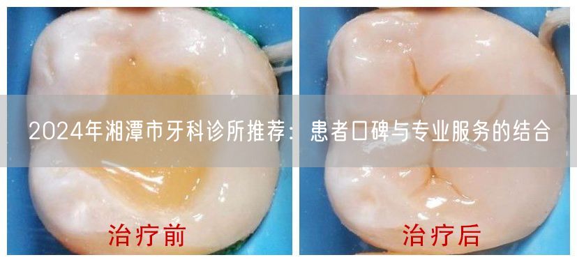 2024年湘潭市牙科诊所推荐：患者口碑与专业服务的结合