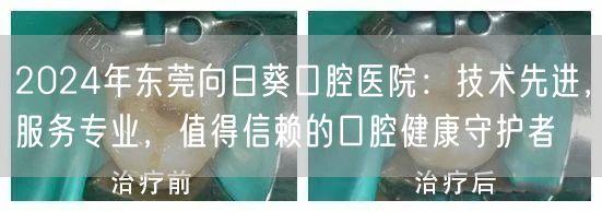 2024年东莞向日葵口腔医院：技术先进，服务专业，值得信赖的口腔健康守护者
