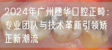2024年广州穗华口腔正畸：专业团队与技术革新引领矫正新潮流