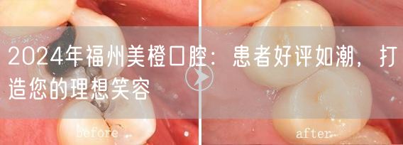 2024年福州美橙口腔：患者好评如潮，打造您的理想笑容